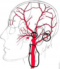 InkedArterial-supply-to-the-scalp-1-External-carotid-artery-2-Ascending-pharyngeal-artery_LI.jpg