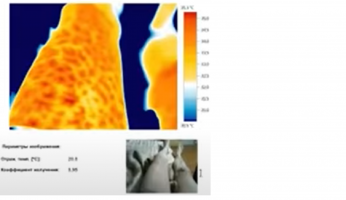 Thermo Image leg.png