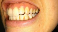 december 16 teeth.jpg