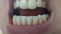 may 17 teeth.jpg
